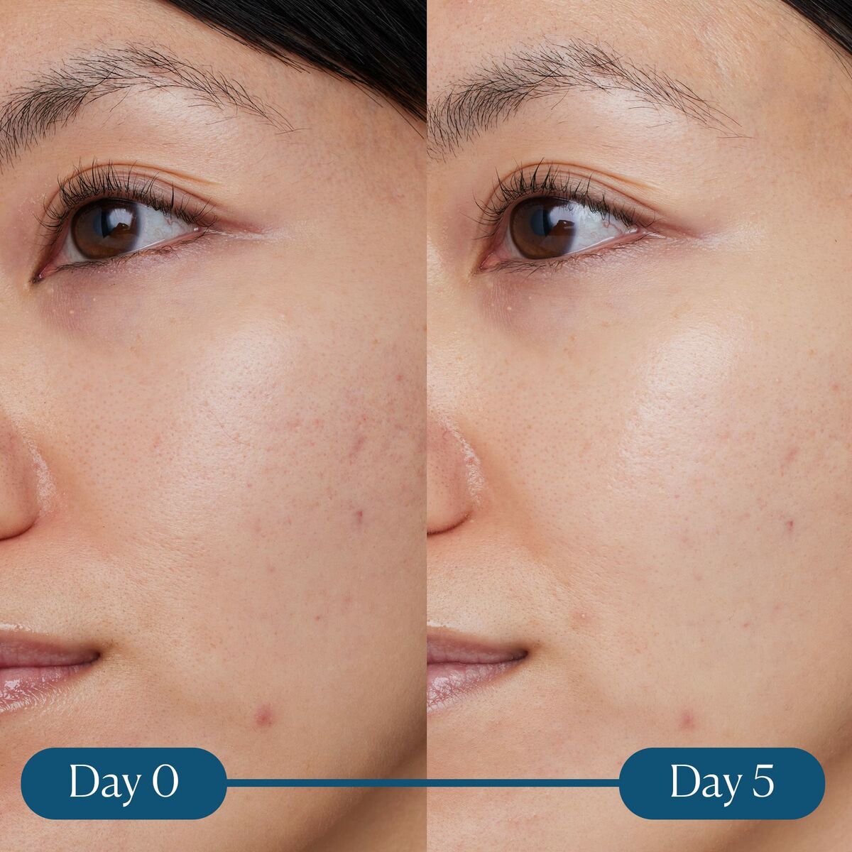 Arcszérum Elemis Dynamic Resurfacing 30 ml