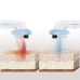 Ultrazvukový kavitačný masážny prístroj proti celulitíde 3 v 1 s infračerveným žiarením a elektrostimuláciou CellyMax InnovaGood